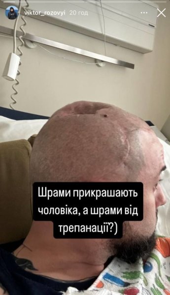 Звезда "Лиги Смеха" Розовый показал последствия трепанации черепа после осколочного попадания на фронте
Звезда "Лиги Смеха" Розовый показал последствия трепанации черепа после осколочного попадания на фронте