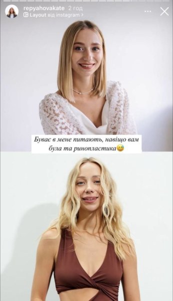 Жена Павлика похвасталась лицом после ринопластики и заговорила о новых операциях
Жена Павлика похвасталась лицом после ринопластики и заговорила о новых операциях