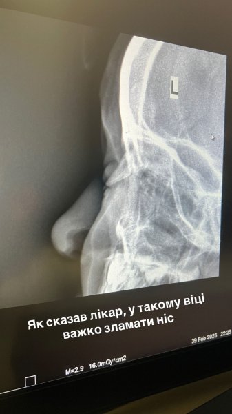 Тимур Мирошниченко вместе с 3-летним сыном попал в больницу поздно вечером
Тимур Мирошниченко вместе с 3-летним сыном попал в больницу поздно вечером