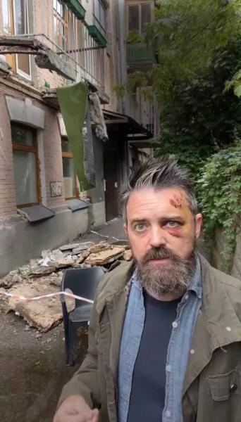 В Киеве обвалился балкон с американским режиссером: Крис Уолтерс показал свои травмы и пригрозил расследованием. Видео