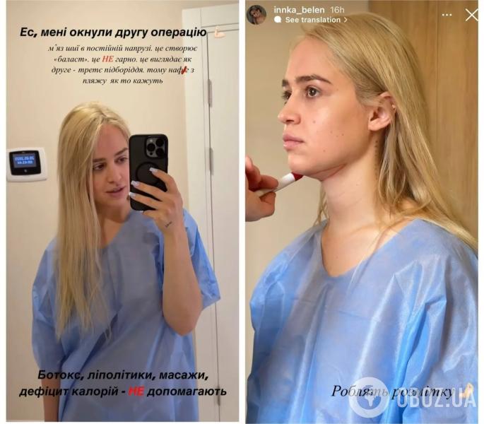 Бывшая девушка "Терена" Инна Белень сделала две пластические операции и рассказала, что изменила в себе. Фото