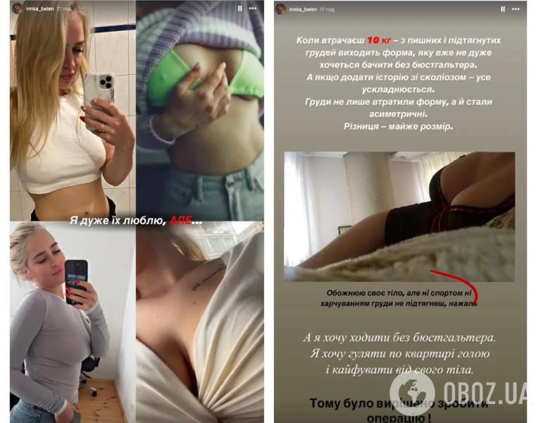 Бывшая девушка "Терена" Инна Белень сделала две пластические операции и рассказала, что изменила в себе. Фото