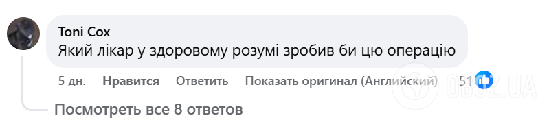 Модель удалила все ребра, чтобы достичь экстремально узкой талии: результат шокировал сеть. Вирусное видео