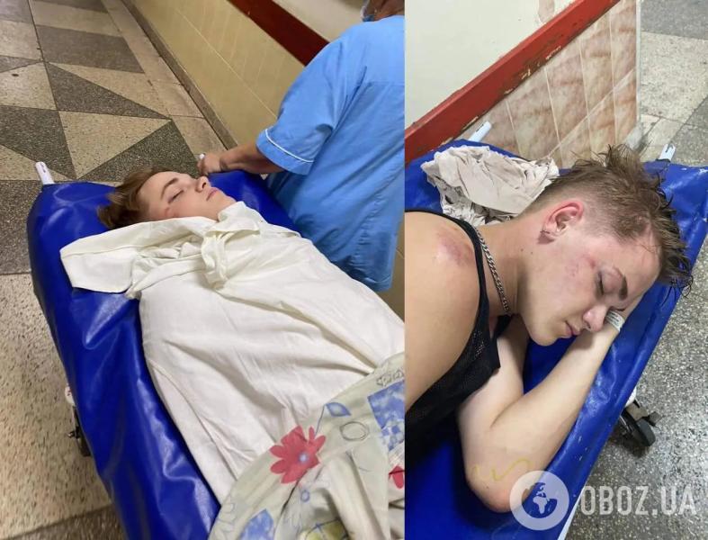 Танцор Дорофеевой, который впал в кому после нападения работника УГО, рассказал о судьбе своего обидчика: он может быть на свободе