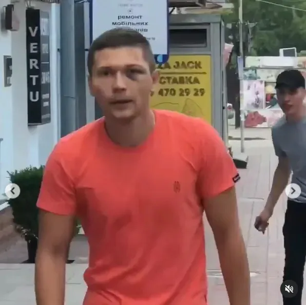 Танцор Дорофеевой, который впал в кому после нападения работника УГО, рассказал о судьбе своего обидчика: он может быть на свободе