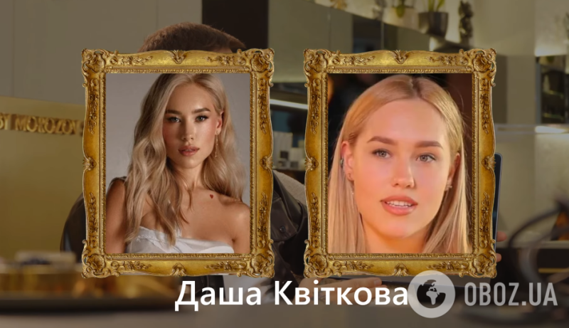 Естественная красота или магия скальпеля? Пластический хирург ответила, делали ли "операции красоты" Дорофеева, Тина Кароль и другие звезды