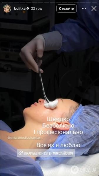 Звезда "Дизель шоу" сделала пластическую операцию на лице. Фото до и после