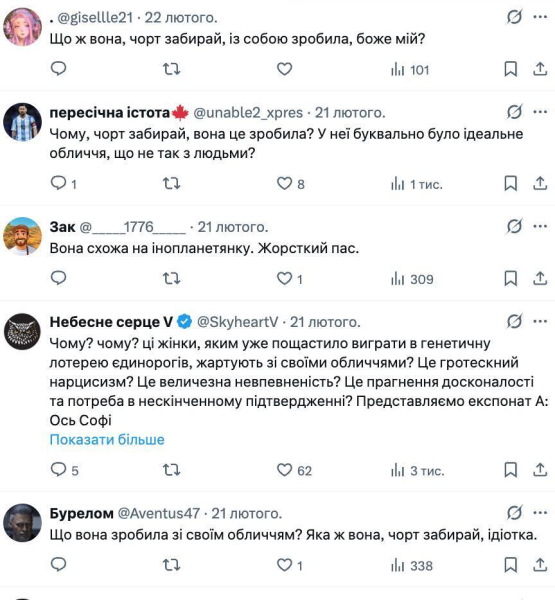 Она испортила свое лицо: сеть обсуждает неузнаваемую звезду "Игры престолов", которая сыграет новую Лару Крофт. Фото тогда и сейчас