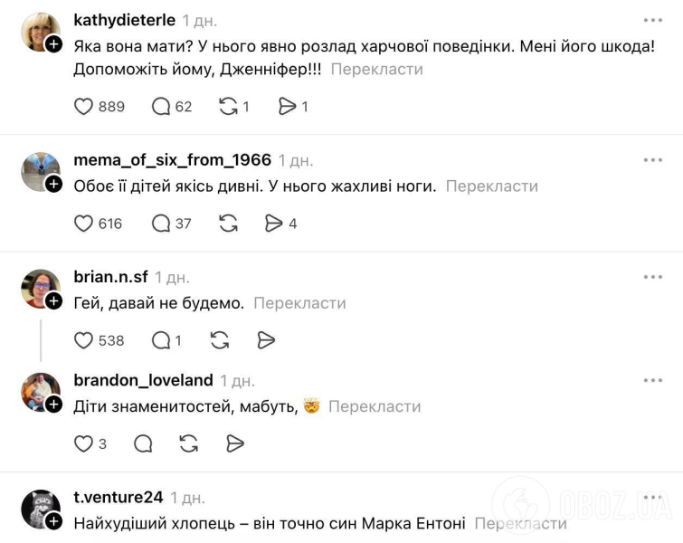 Ноги 18-летнего сына Дженнифер Лопес не на шутку напугали сеть: фанаты умоляют помочь ему