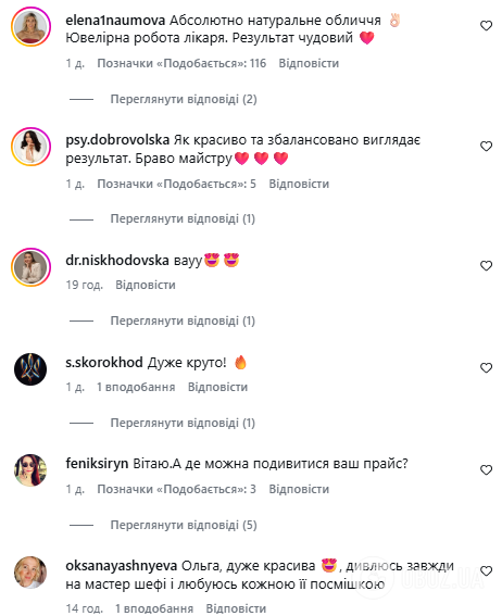 Подтяжка и увеличение губ: звезда "МастерШеф" Мартыновская ошарашила результатом "ювелирной" работы косметологов: каким было ее лицо до